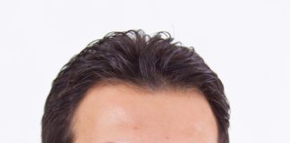 Screening cancro colon-retto, oltre 150 prenotazioni