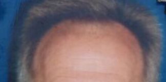 San Nicola la Strada: arrestato l’omicida dell’imprenditore, fuga finita a Casoria