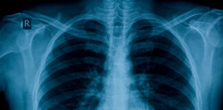 Incredibile in Campania, detenuto ingoia telefonino: scoperta shock dopo un mese