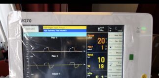 Coronavirus, il colosso cinese Zte dona 5 ventilatori polmonari alla Campania: destinati al centro Covid dell’ospedale del Mare di Napoli