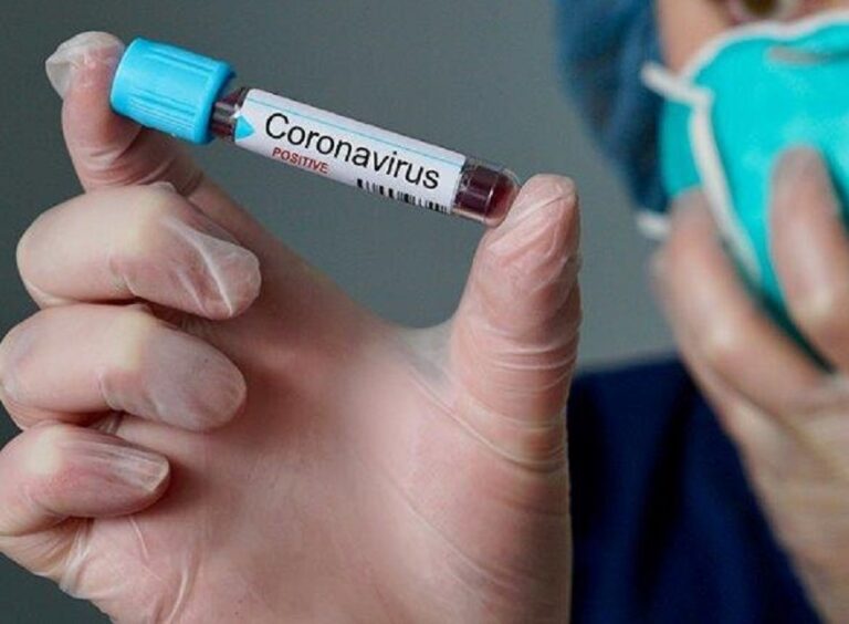 Coronavirus a Napoli, altro caso positivo nel capoluogo partenopeo: sale a 976 il bilancio dei contagi. Un nuovo decesso. Due guariti nelle ultime 24 ore: 445 in totale