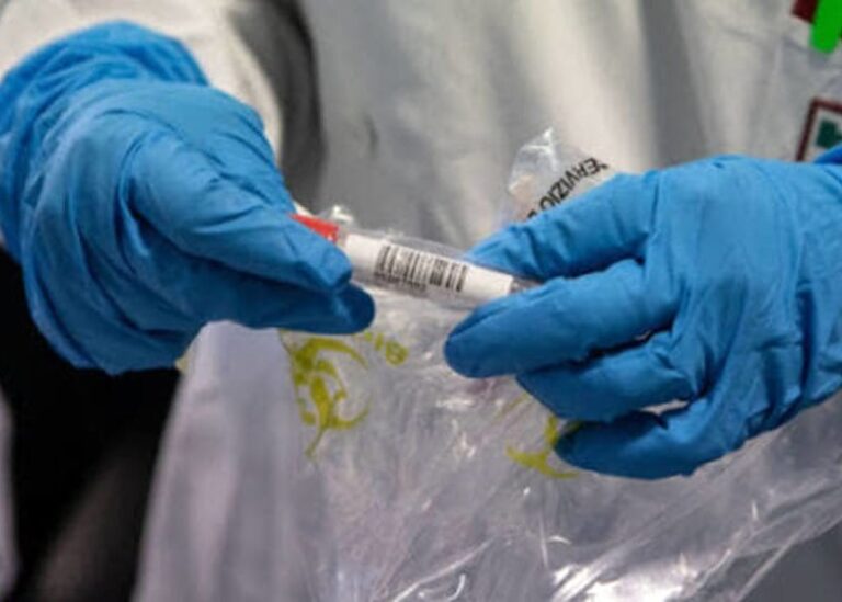 BOLLETTINO CORONAVIRUS IN CAMPANIA  Altri 11 casi positivi al Covid-19: sale a 4.695 il bilancio dei contagi. Eseguiti 3.691 tamponi