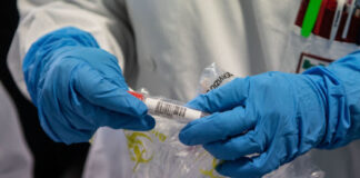 LA TABELLA Coronavirus in Campania, età dei malati più bassa della media nazionale, test per tutti i medici. Quasi 650 contagiati