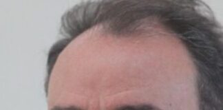 Aversa, morta la madre del giudice Nicola Graziano. Oggi alle 16.00 funerali al Duomo