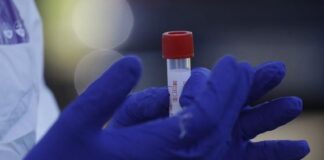 Coronavirus a Napoli, 3 nuovi positivi nel capoluogo partenopeo: sale a 967 il bilancio dei contagi. Due nuovi decessi. Dieci guariti nelle ultime 24 ore: 379 in totale