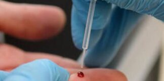 Emergenza Covid, partiti gli screening di massa nella ‘area pilota’ di Ariano Irpino: effettuati già oltre 7mila test sierologici