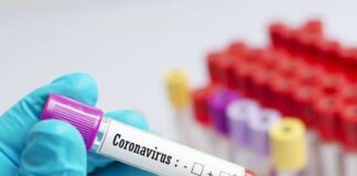 Covid-19: situazione sotto controllo in provincia di Caserta, tre nuovi casi in un campo rom di Napoli