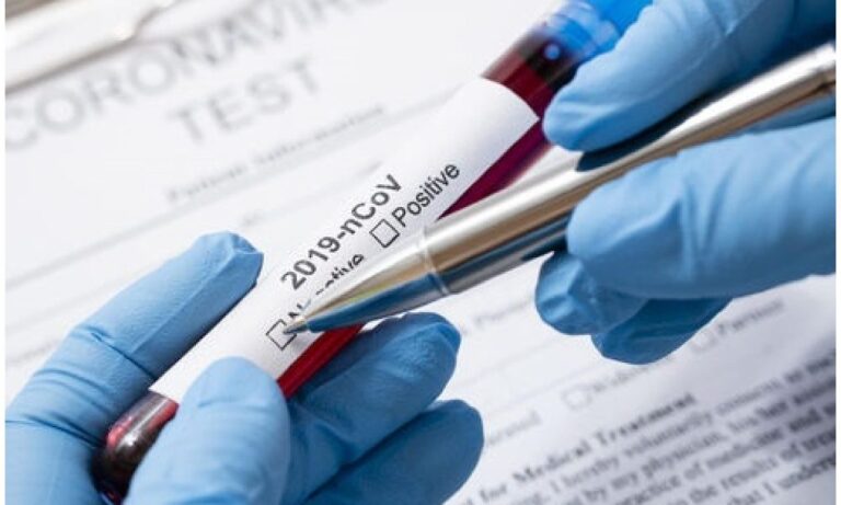 Covid, lo studio su Lancet: “Con le scuole chiuse 4 settimane il contagio diminuisce del 15%».
