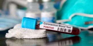 Ecco la tabella dei positivi totali e di quelli attuali di tutti comuni della provincia di Caserta