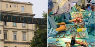 Eccezionale intervento al policlinico Vanvitelli, ricostruito un arto con ossa di cadavere e staminali