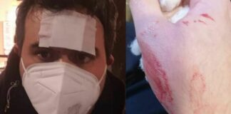 Casavatore, il prof picchiato dal pm. Intanto sui social viene criticato da alcune mamme