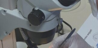 Nuova Circolare del Ministero della Salute alle Regioni: “Contro la Dengue sorveglianza e bonifiche”