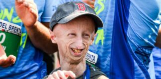 È morto a 28 anni Sammy Basso è morto, era il più longevo malato di progeria. Jovanotti: “Immenso dispiacere”