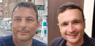 Ospedale Moscati, Forza Aversa: “Personale del Pronto soccorso martoriato da barbarie, Matacena intervenga”