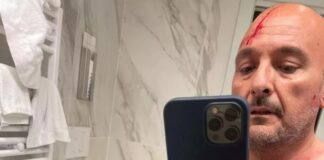 Boccia-Sangiuliano, ecco la seconda foto con l’ex ministro ferito alla testa