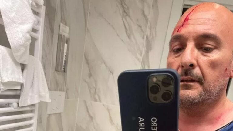 Boccia-Sangiuliano, ecco la seconda foto con l’ex ministro ferito alla testa